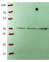 CHS | Chalcone synthase in the group Antibodies Plant/Algal / Hormones / Biosynthesis/regulation at Agrisera AB (Antibodies for research) (AS12 2615)